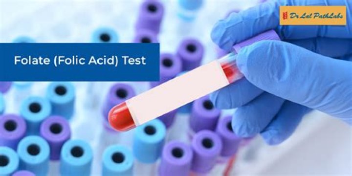 Acid test - How To Discuss