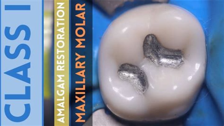 Amalgam Well - How To Discuss