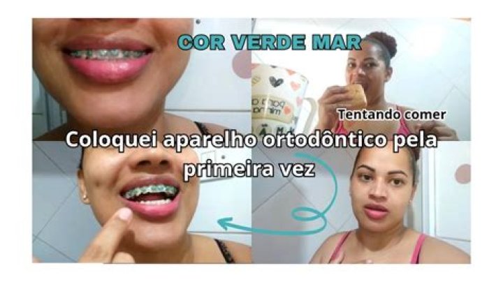 Aparelho Verde Mar - How To Discuss