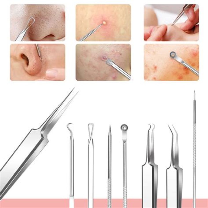 Blackhead cleaner - How To Discuss