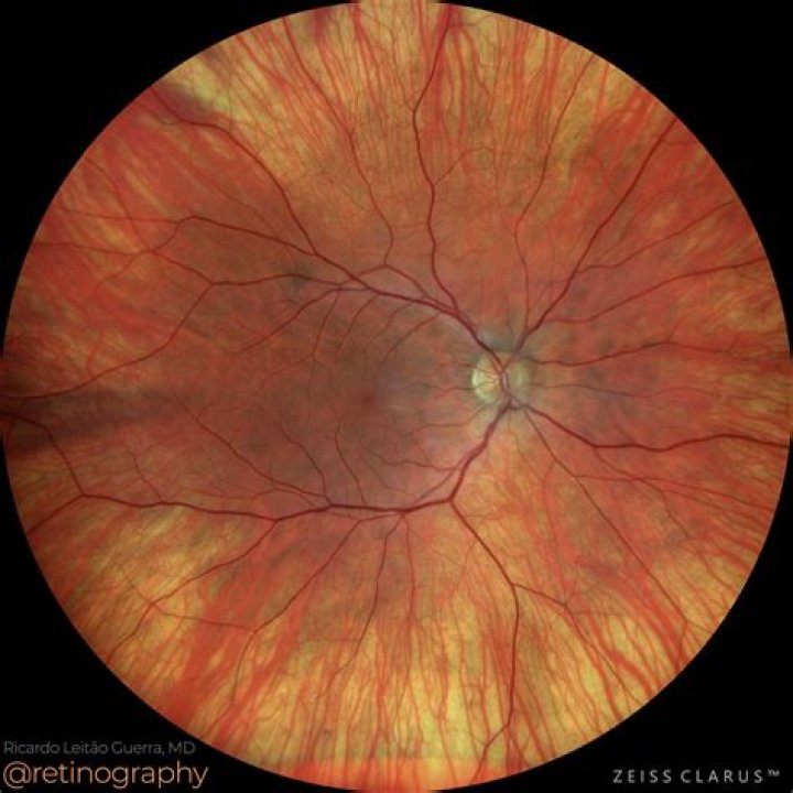 Blonde Fundus - How To Discuss