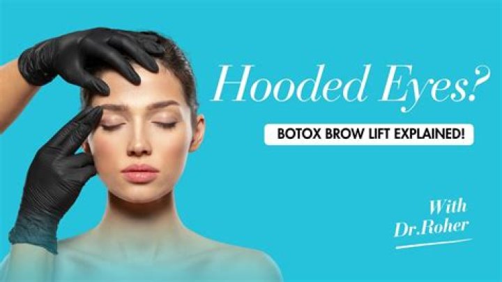 Botox for hooded eyes - How To Discuss