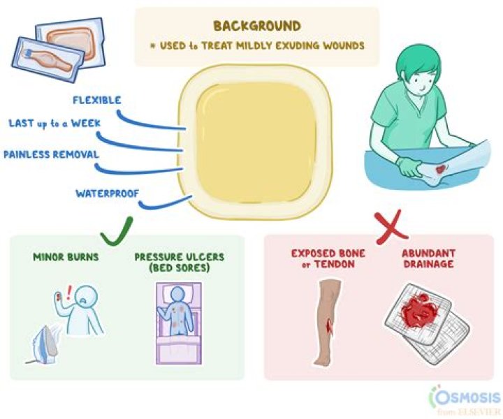 Burst Ulcer - How To Discuss