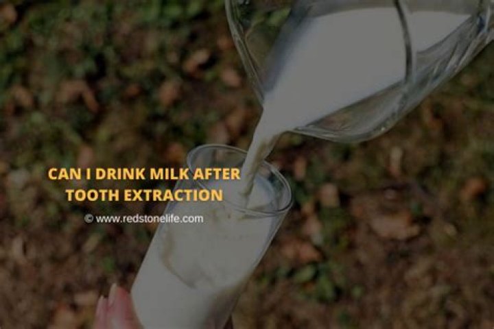 Can I Drink Milk After Tooth Extraction