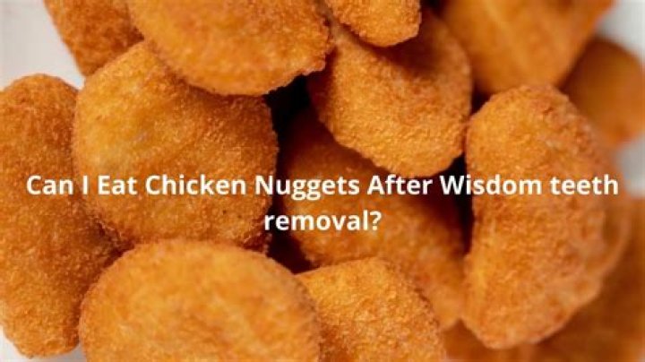 Can I Eat Chicken Nuggets After Wisdom Teeth Removal