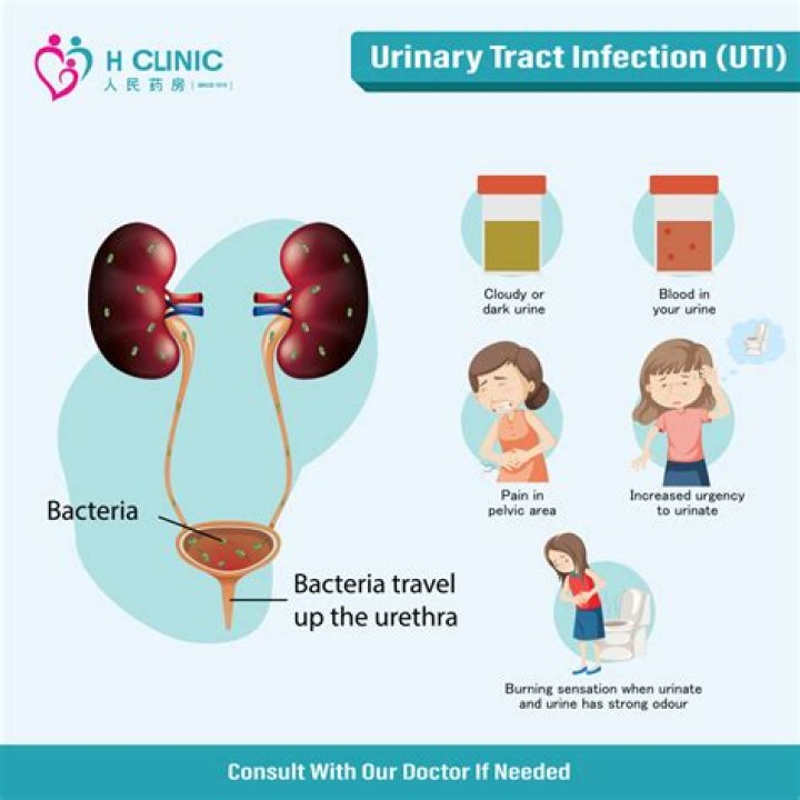 Can Summer's Eve Cause Uti