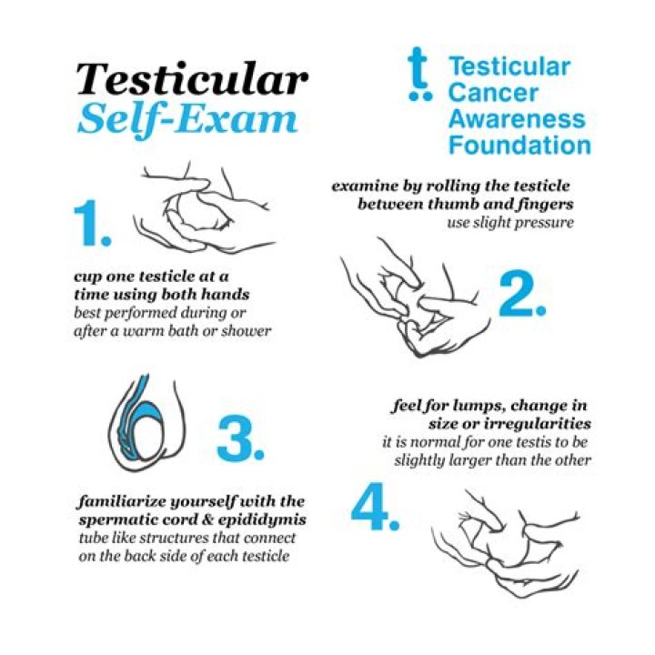 Can You Refuse A Testicular Exam