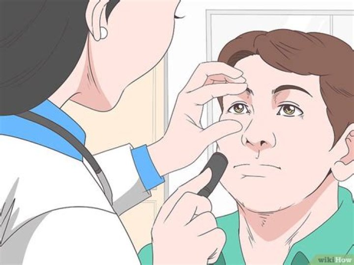 Como Tirar Cisco Do Olho