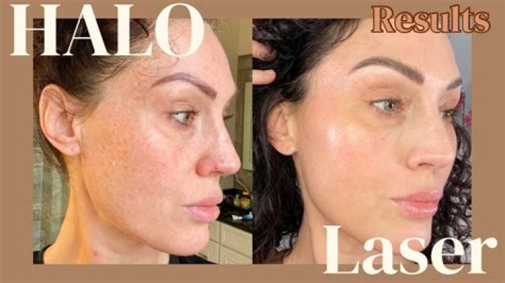 Face halo - How To Discuss