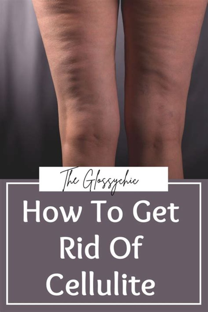 Get rid of cellulite - How To Discuss