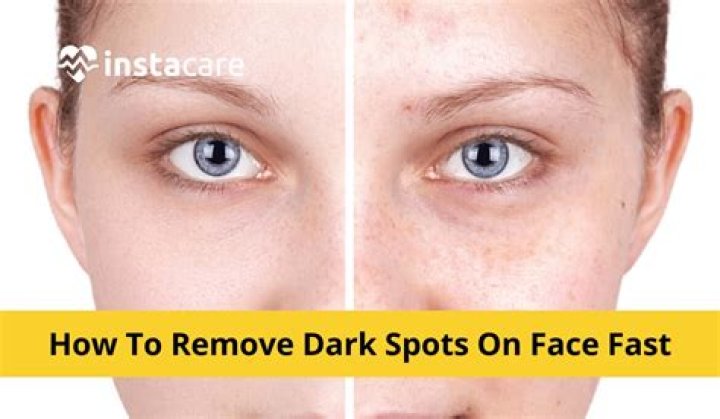 Get rid of dark spots on face