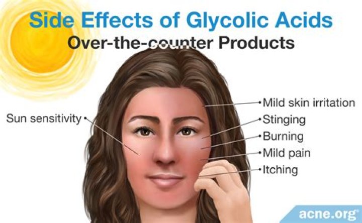 Glycolic acid acne - How To Discuss