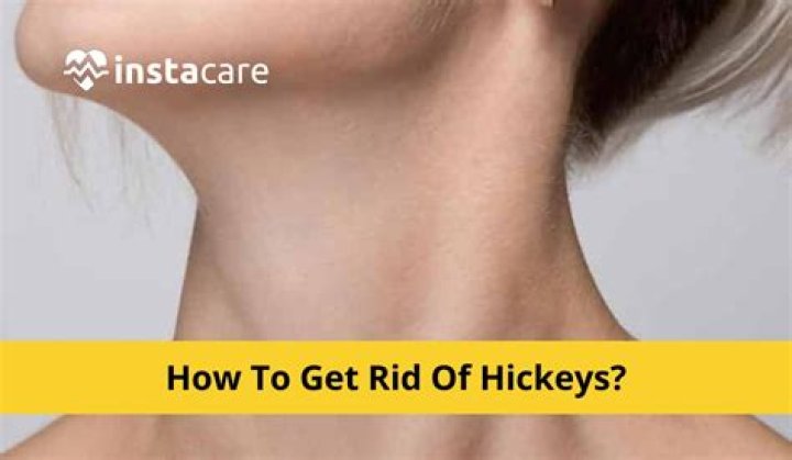 Hickeys On Stomach - How To Discuss