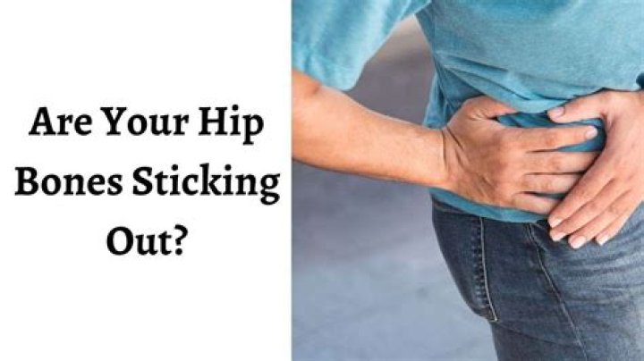 Hip Bones Stick Out - How To Discuss