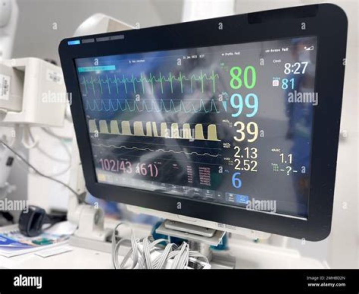 Hospital monitor - How To Discuss