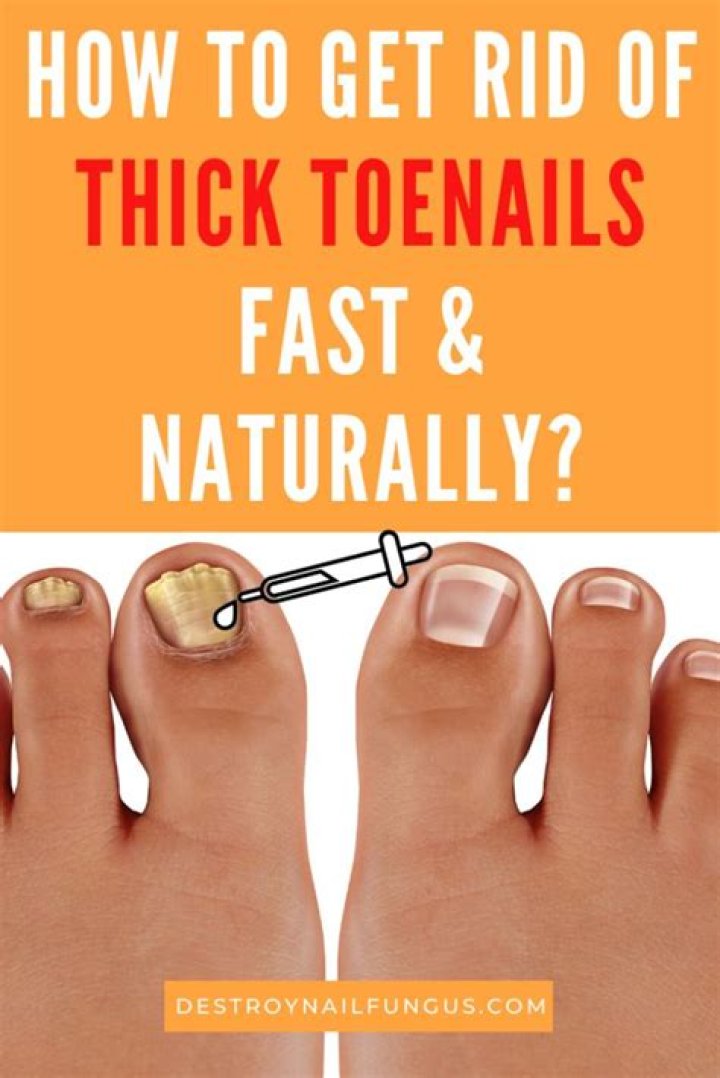 How To Get Rid Of Thick Toenails