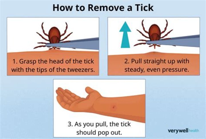 How to Remove a Tick