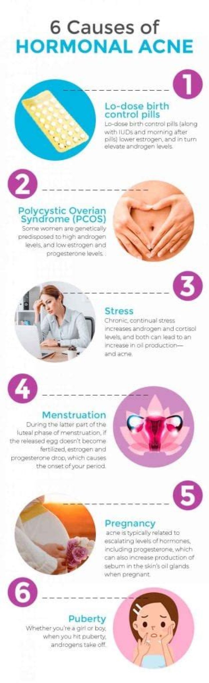 How to stop hormonal acne