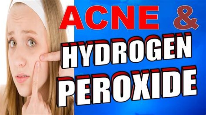 Hydrogen peroxide on pimples - How To Discuss