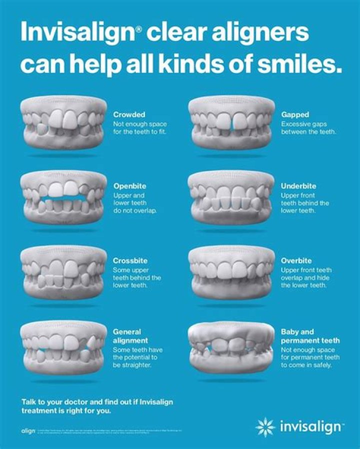 Invisalign And Smoking - How To Discuss