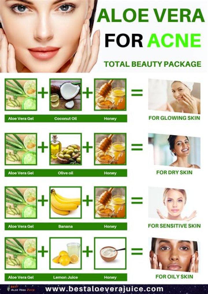 Is aloe vera good for acne