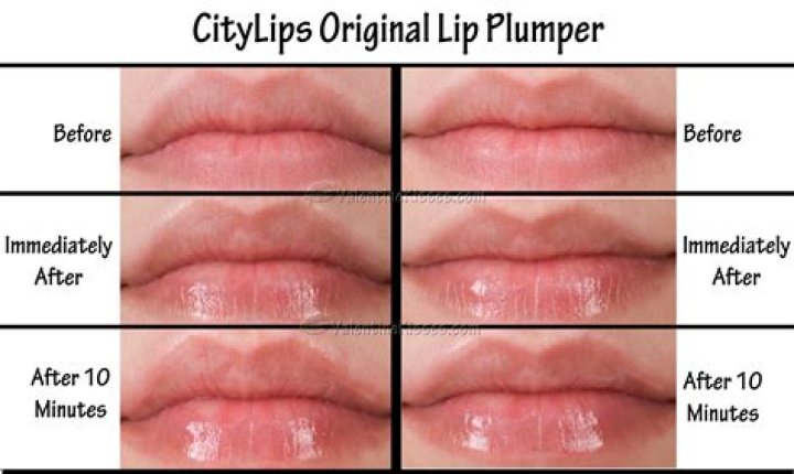 Lip plumper before and after