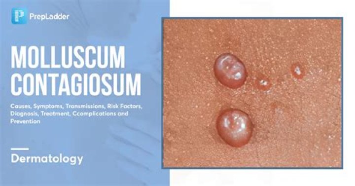 Maluscum - How To Discuss