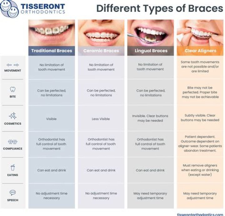 Nyu Dental Braces - How To Discuss
