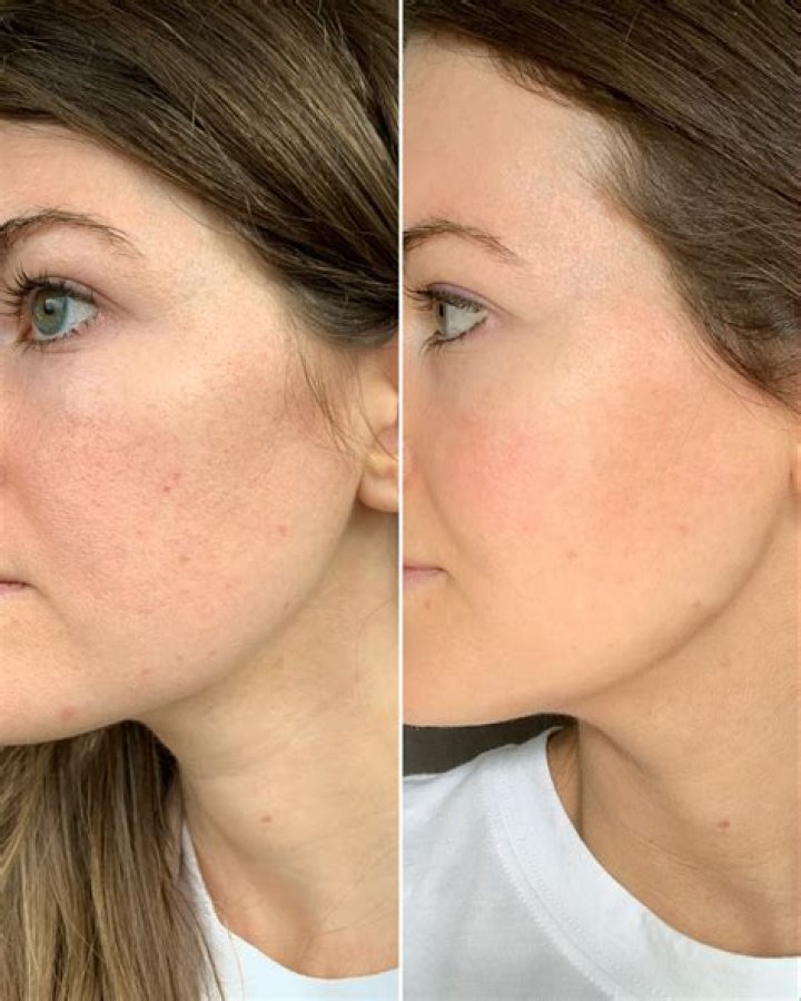 Olay retinol 24 before and after