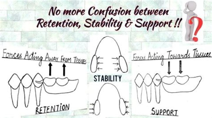 Partial Retention - How To Discuss