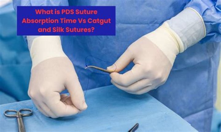 Pds Suture Absorption Time - How To Discuss