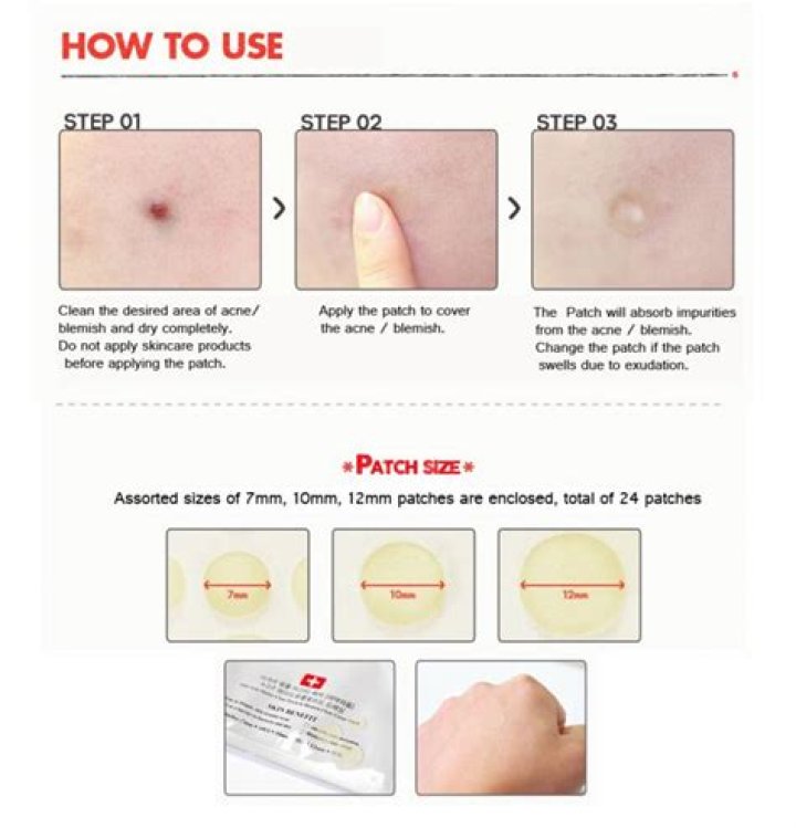 Pimple stickers - How To Discuss