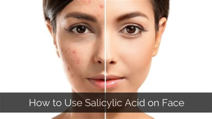 Salicylic acid exfoliant - How To Discuss