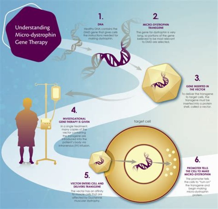 Sarepta therapeutics stock - How To Discuss