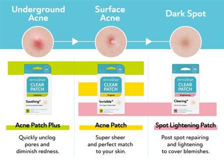 Silicone patches - How To Discuss