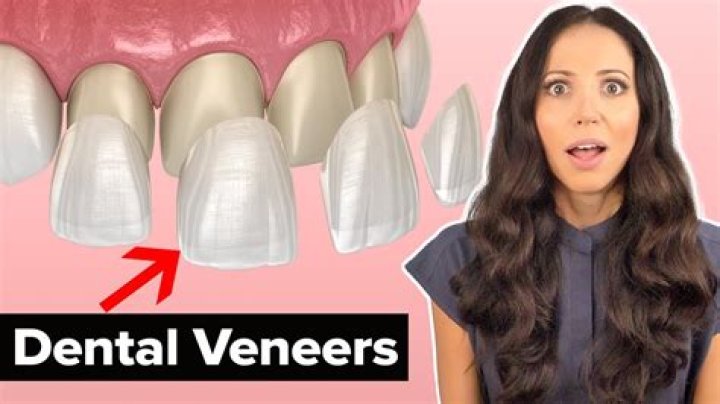 Teeth after veneers removed - How To Discuss