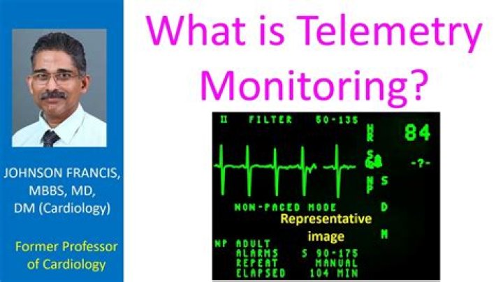 Telemetry - How To Discuss