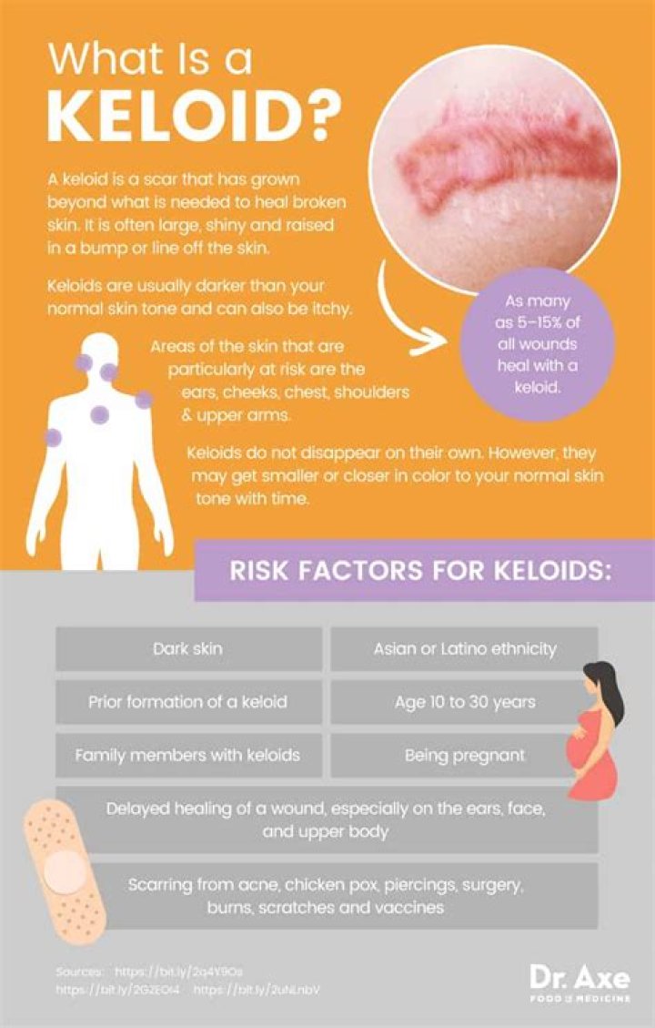 Toothpaste On Keloid - How To Discuss