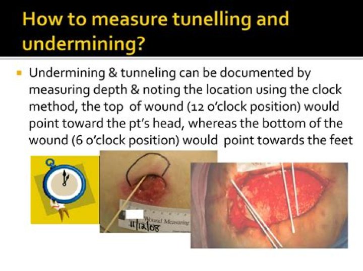 Tunneling - How To Discuss
