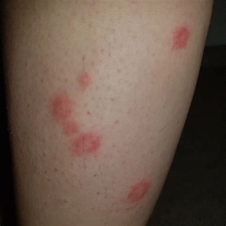 Whats biting me at night