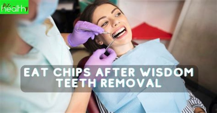 When Can I Eat Chips After Wisdom Teeth Removal?