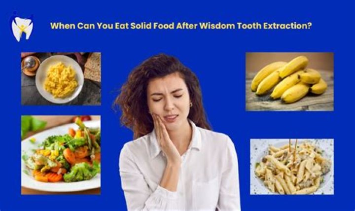 When Can I Eat Solid Food After Wisdom Teeth Removal
