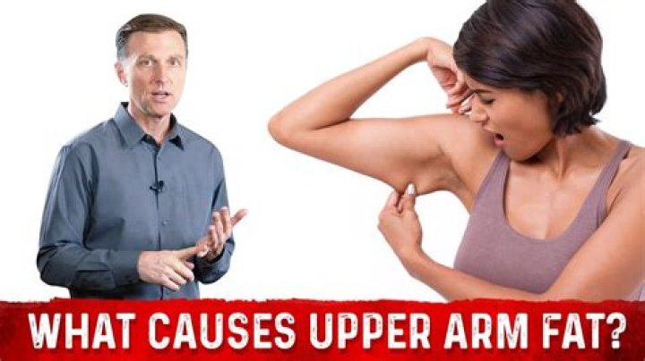 Why are my upper arms so fat