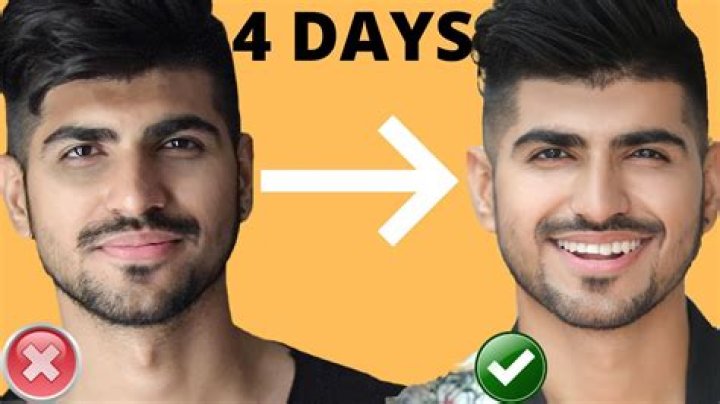 Why Do Indians Have Dark Circles