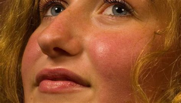 Why does a person's face become flushed when they are working hard?